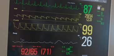 Advance Heart Failure Treatment - Apex Heart Clinic