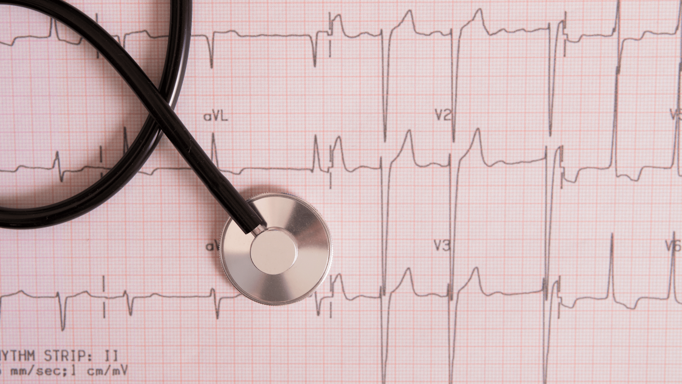 Read more about the article Is an Electrocardiogram Enough to Diagnose Heart Problems or Do You Need Further Tests?